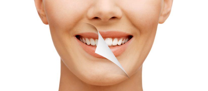 3 Benefits of Visiting a Cosmetic Dentist in Hollywood