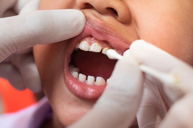 Fluoride Appointments Coral Gables